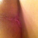 Healing on up!