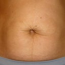 Taken the day before surgery..can't even see my belly bottom.