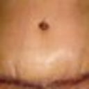 Day 6-swollen but still with the flat tummy