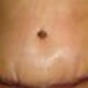 the scar doesn't look pretty