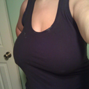 pre op in shirt without bra.