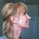 4-Weeks 2-days post opp. Love My New Look!