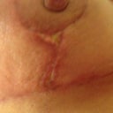 Under right side
