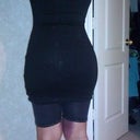5 days post-op w/ girdle on. Lots of bruising and swelling but booty is bigger.