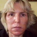 1 Day After Chemical Peel