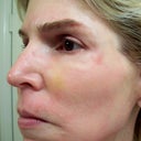 4 Days After