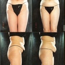 Before (left) and after (right)