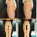 Before (left) and after (right)