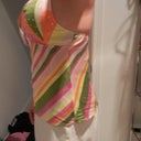 2 weeks after surgery
