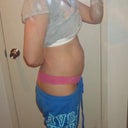 6 months Post-op & after a feeling of the stitch breaking.
