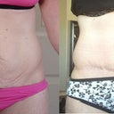 Just a before and after side by side - 7 months