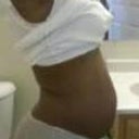 This is before the surgery
