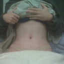 I haven't had a proper belly button in 13 years...