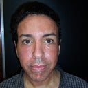 THE NEXT DAY FRONT VIEW (Bronzing of the skin)