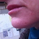 Day 7 - duck lips.