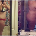 Before and 6 months post op
