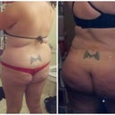 Before and 6 months post op