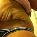 Infection. Hurt like a bitch 5 weeks