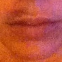 Evening of day 2. Purple bruise much worse, but swelling has really gone down.