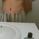 5 weeks 1 day po. This is the rt side that needs some lipo.