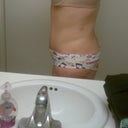 5 weeks 3 days. rt side again you can see the fatty part.