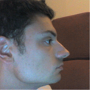 profile 2 pre-op