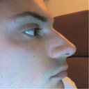 profile 3 pre-op