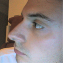 profile 4 pre-op