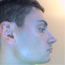 2 weeks post op