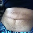 Before:My Yucky embarrassing Pic