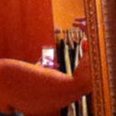 Back of arm before surgery