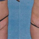 Pics by my dr.