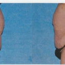 Pics by my dr.