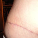 7 weeks - looks good