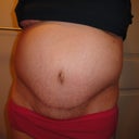 8 weeks - distended