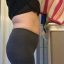11 26 12 Leggings - Pre-op