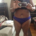 Actually, still a lil swollen!!