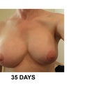 35 days out.
