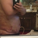 Notice the uneven incision