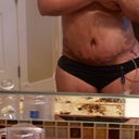 Incision not as low as I thought initially