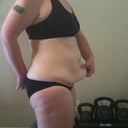 Photos taken day before surgery.