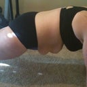 Photos taken day before surgery.