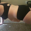 Photos taken day before surgery.