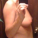 Side view in the buff before surgery.