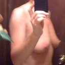 2nd side view in the buff before surgery.