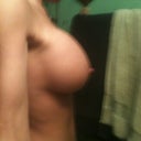 Side view in the buff post-op. 44 days out