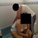 As gross as this may seem, but here is a pic of what exactly it means when I say draining my back. This is me sitting on the edge of the tub and Virginia draining my back from the little whole that is left so fluid of the lipo is decreased.