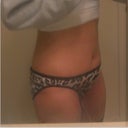 Day 13 Post Op. OK, I see that I need to clean my mirror , but that aside- I AM SO EXCITED!!!! I feel great and am VERY satisfied with how my tummy is shaping up!!