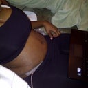 4 days post op