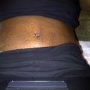 4 days post op